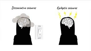 The CODES trial for dissociative seizures