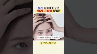 필러 맞았는데… 다른데에 가있는거 같다고요? 