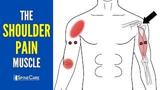 The Shoulder Pain Muscle (How to Release It for INSTANT RELIEF)