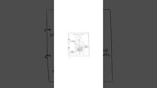 IBS - Explained #healthsketch #shorts