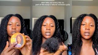 Why my hair is falling out in clumps and how I manage it |shed hair vs breakage | chitchat