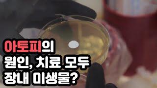 아토피 피부염의 원인과 치료는 모두 장으로부터?  / YTN 사이언스