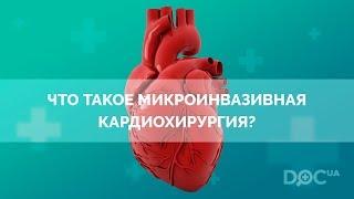 Сердечно-сосудистая хирургия: что такое микроинвазивная кардиохирургия?