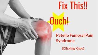 How to Fix Patellofemoral Pain Syndrome (Clicking Knee)