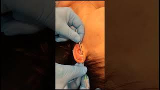 #RookPiercing & #AntiTragusPiercing by Jabba @get-piercedltd Carlisle, Cumbria #Piercing