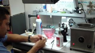 Complete denture border molding tips