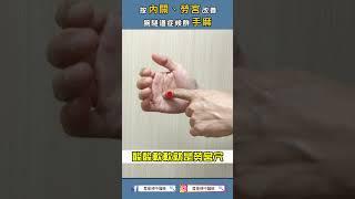 按內關、勞宮改善腕隧道症候群手麻