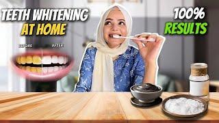 Teeth Whitening At Home | Guaranteed Results | No More Yellow Teeth | Dietitian Aqsa