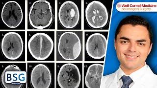 Introduction to Neuroimaging - Neurosurgery Training Center