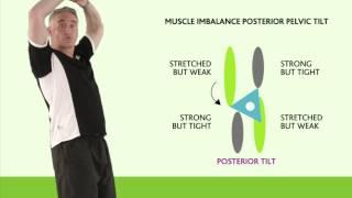 Posture - Correcting Posterior Pelvic Tilt