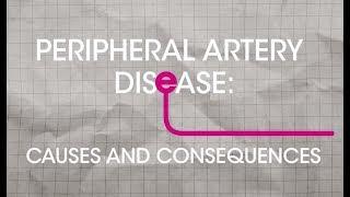 What is Peripheral Artery Disease (PAD): Causes and Consequences