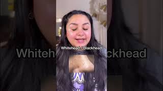 Cheap pharmacy products for Skin Problems #facedecor #youtubeshorts