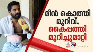 കുളം വൃത്തിയാക്കുന്നതിനിടെ മീൻ കൊത്തി, അണുബാധയെ തുടർന്ന് യുവാവിൻ്റെ കൈപ്പത്തി മുറിച്ചുമാറ്റി| Kannur