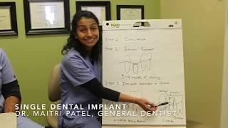Single Dental Implant by Drs. Amit Kamat & Maitri Patel