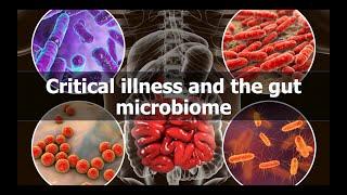 Critical illness and the gut microbiome