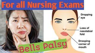 Bell's Palsy in hindi! By RS Nursing Academy ! for all nursing exam
