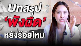 บทสรุป พังผืดหลังการร้อยไหม