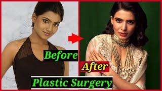 Shocking Plastic Surgery of South Indian Actresses | Samantha Akkineni, Kajal Aggarwal, Anushka