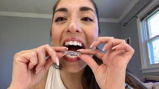 How to put on/take off your TMJ Orthotic Splint