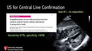 Ultrasound for Central Line Confirmation