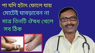 Homeopathic doctor || পা ফোলা বা Dropsy রোগের সফল ঔষধ ও চিকিৎসা || Dr SP Goswami