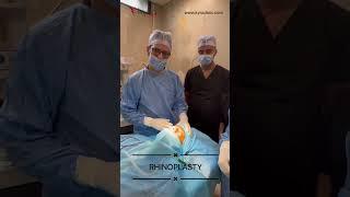 Rhinoplasty Surgery Experts Dr Vikas Gawri at Kyra clinic Ludhiana Punjab