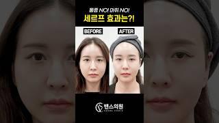 마취 없이 받는 신상 고주파 리프팅 장비! #세르프 효과 있을까?