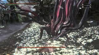 Bloodborne - 99 VIT, One Hit #07