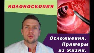 Колоноскопия. Осложнения. Примеры.