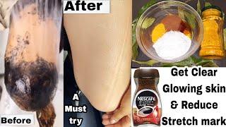 A must try / body scrub for glowing skin stretch mark removal/diy coffee body scrub & Polish #coffee