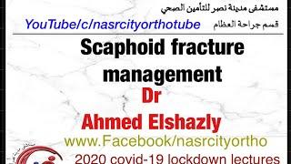 Scaphoid fracture management.Dr Ahmed Elshazly. Nasrcity online 2020