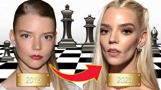 The Extensive Plastic Surgeries of Anya Taylor Joy; So Much So Young