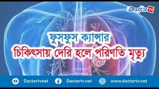 ৮৫ থেকে ৯০ ভাগ ফুসফুসে ক্যানসারের জন্য দায়ী ধূমপান|| ডক্টর টিভি || Doctor TV