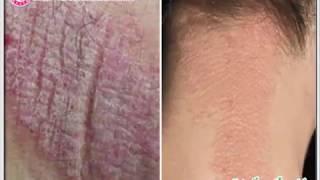 Phòng khám bệnh da liễu TPHCM nào an toàn và uy tín
