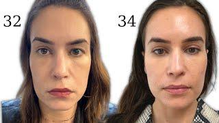 I spent $30,000 on anti-aging treatments - What's worth it?