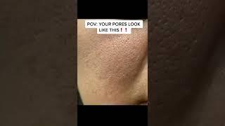 Do you PORES LOOK THIS LARGE?!!!! #skincareroutine #skincare