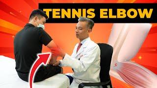 Đau Cùi Chỏ Không Thể Cầm Cốc Nước? Bác Sĩ Hướng Dẫn Chữa Tennis Elbow  | Y học Thể thao Starsmec