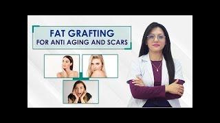 FAT GRAFTING FOR ANTI AGING AND SCARS | Dr. Smriti Shrestha