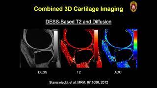 ISMRM MR Academy - Acceleration Methods for Musculoskeletal Imaging