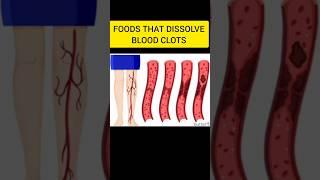 Foods That Dissolve Blood Clots #trending #shorts