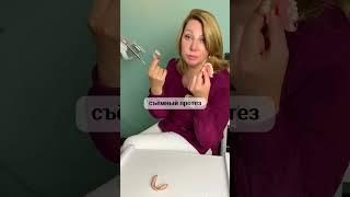 Если современные съёмные протезы не для вас, то ждём вас на имплантацию! #имплантациязубовспб