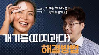 개기름, 피지과다의 원인 2가지 & 해결방법