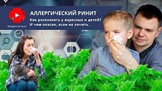 Аллергический ринит. Как распознать у взрослых и детей? И чем опасен, если не лечить.