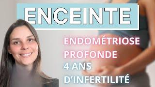 Témoignage : Endométriose profonde, FIV, infertilité