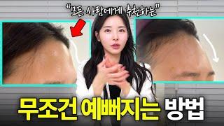 내 이마도 가능할까? 이마 모양별 이마필러 후기!
