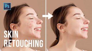 Skin Retouching in Photoshop