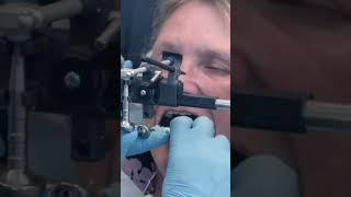 Facebow recording for perfect smile | bite | dentist dentistry #shorts #health #beauty