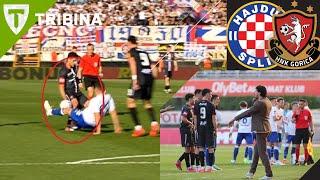 Ruka ili ne ? | Elezi | Hajduk Split - Gorica