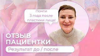 РЕАЛЬНЫЙ ОТЗЫВ / ОМОЛОЖЕНИЕ ЛИЦА + ПЛАСТИКА ГУБ #кочнева #абриелль