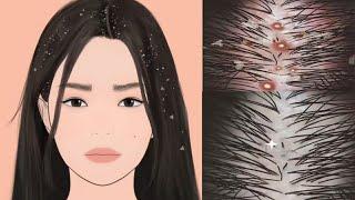 [ ASMR ] head lice removal animation | asmr head lice treatment | One Animation